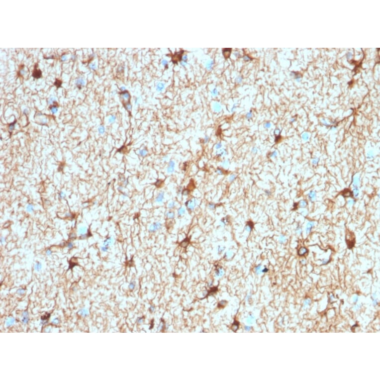 Immunohistochemistry - Anti-GFAP Antibody [ASTRO/1974R] (A248712) - Antibodies.com