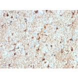 Immunohistochemistry - Anti-GFAP Antibody [ASTRO/1974R] (A248712) - Antibodies.com