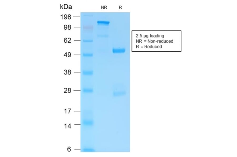 SDS-PAGE - Anti-GFAP Antibody [ASTRO/1974R] (A248712) - Antibodies.com