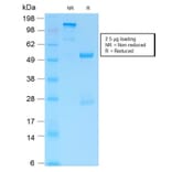 SDS-PAGE - Anti-GFAP Antibody [ASTRO/1974R] (A248712) - Antibodies.com