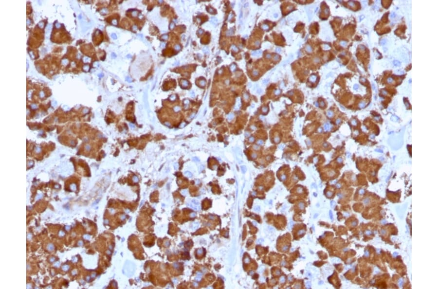 Immunohistochemistry - Anti-Growth Hormone Antibody [GH/1371] (A248713) - Antibodies.com