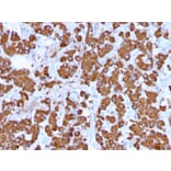 Immunohistochemistry - Anti-Growth Hormone Antibody [GH/1371] (A248713) - Antibodies.com