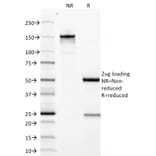 SDS-PAGE - Anti-Growth Hormone Antibody [GH/1371] (A248713) - Antibodies.com