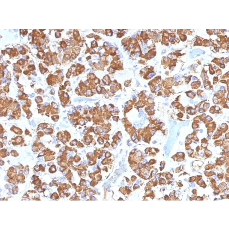 Immunohistochemistry - Anti-Growth Hormone Antibody [GH/1450] (A248713) - Antibodies.com