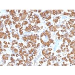 Immunohistochemistry - Anti-Growth Hormone Antibody [GH/1450] (A248713) - Antibodies.com