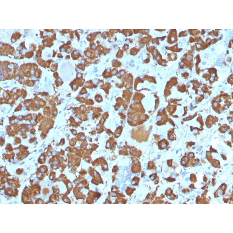 Immunohistochemistry - Anti-Growth Hormone Antibody [SPM106] (A248714) - Antibodies.com