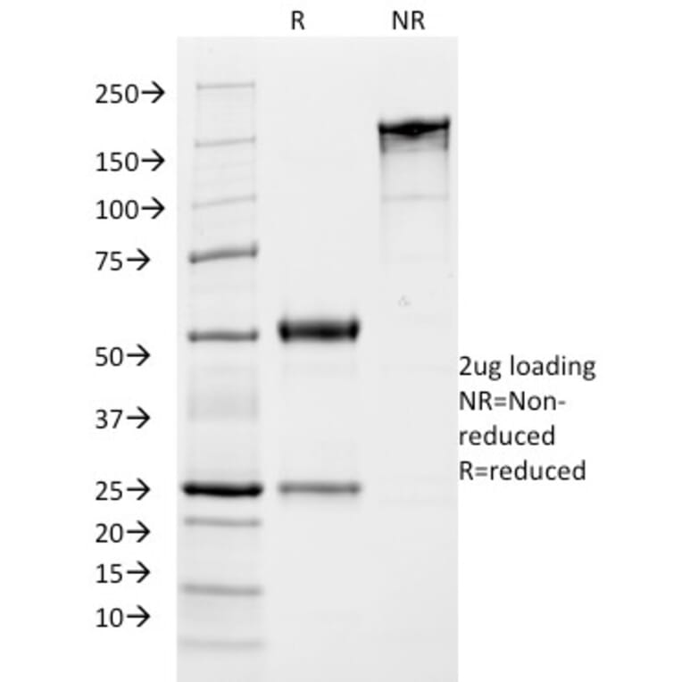 SDS-PAGE - Anti-Growth Hormone Antibody [SPM106] (A248715) - Antibodies.com