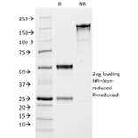SDS-PAGE - Anti-Growth Hormone Antibody [SPM106] (A248715) - Antibodies.com
