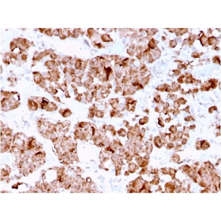 Immunohistochemistry - Anti-Growth Hormone Antibody [GH/3155] (A248717) - Antibodies.com