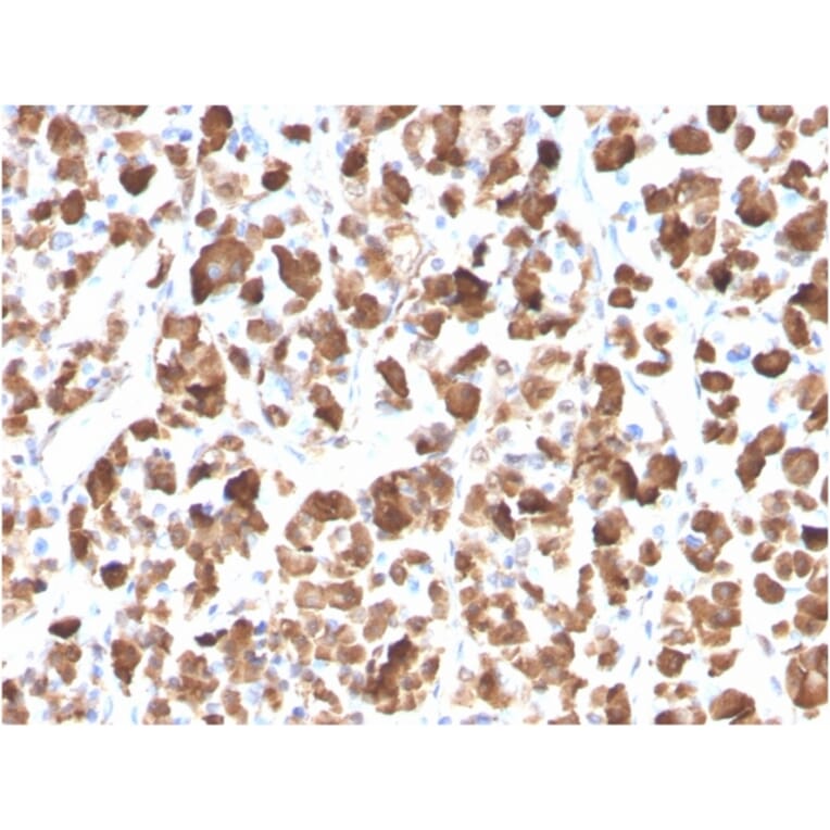 Immunohistochemistry - Anti-Growth Hormone Antibody [GH/3155] (A248717) - Antibodies.com