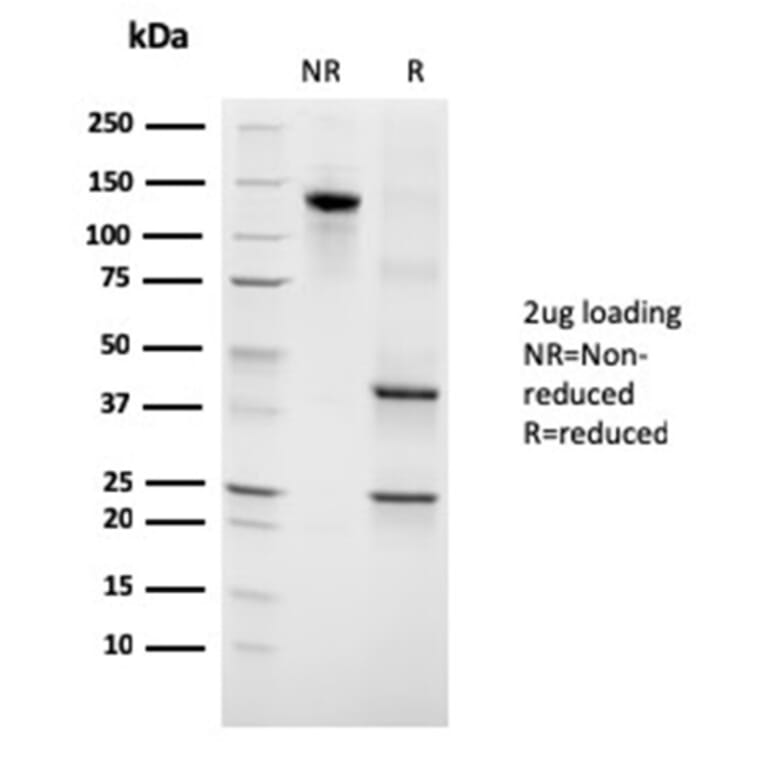 SDS-PAGE - Anti-Growth Hormone Antibody [GH/3155] (A248717) - Antibodies.com