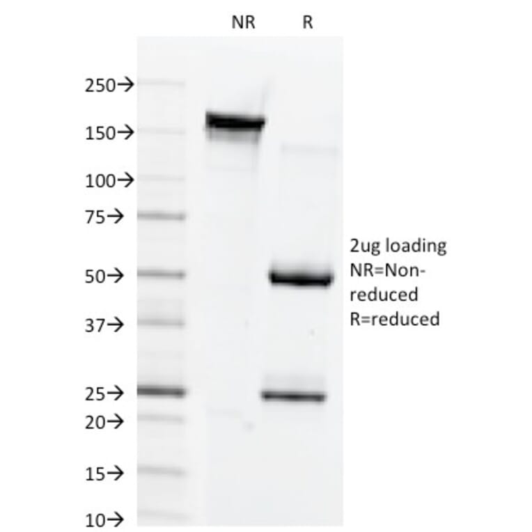 SDS-PAGE - Anti-Connexin 32 Antibody [M12.13] (A248717) - Antibodies.com
