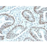 Immunohistochemistry - Anti-FOXP1 Antibody [FOXP1/44R] (A248719) - Antibodies.com