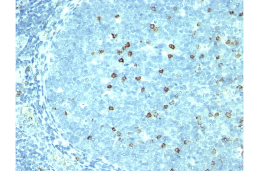 Immunohistochemistry - Anti-CD57 Antibody [SPM527] (A248721) - Antibodies.com