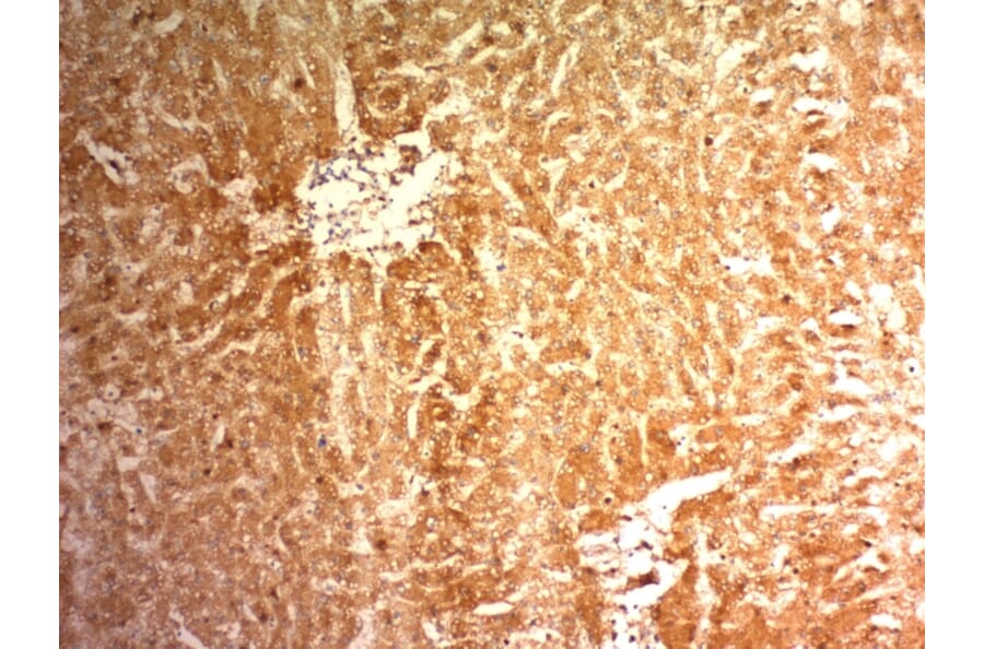 Immunohistochemistry - Anti-Glypican 3 Antibody [1G12] (A248727) - Antibodies.com