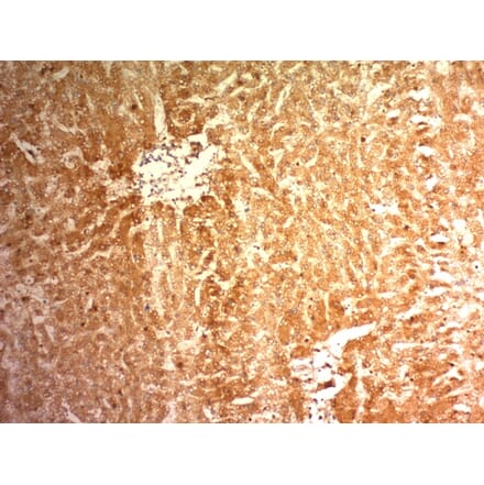 Immunohistochemistry - Anti-Glypican 3 Antibody [1G12] (A248727) - Antibodies.com