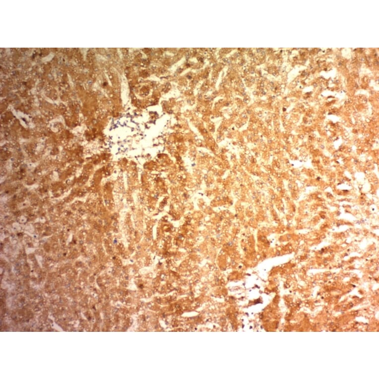 Immunohistochemistry - Anti-Glypican 3 Antibody [1G12] (A248727) - Antibodies.com