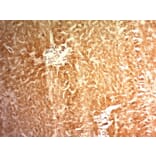 Immunohistochemistry - Anti-Glypican 3 Antibody [1G12] (A248727) - Antibodies.com