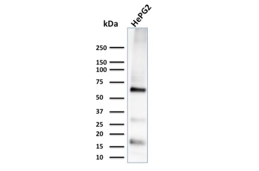 Western Blot - Anti-Glypican 3 Antibody [1G12] (A248727) - Antibodies.com