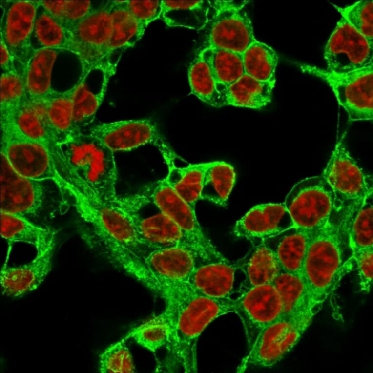 Immunofluorescence - Anti-Glypican 3 Antibody [1G12] (A248727) - Antibodies.com