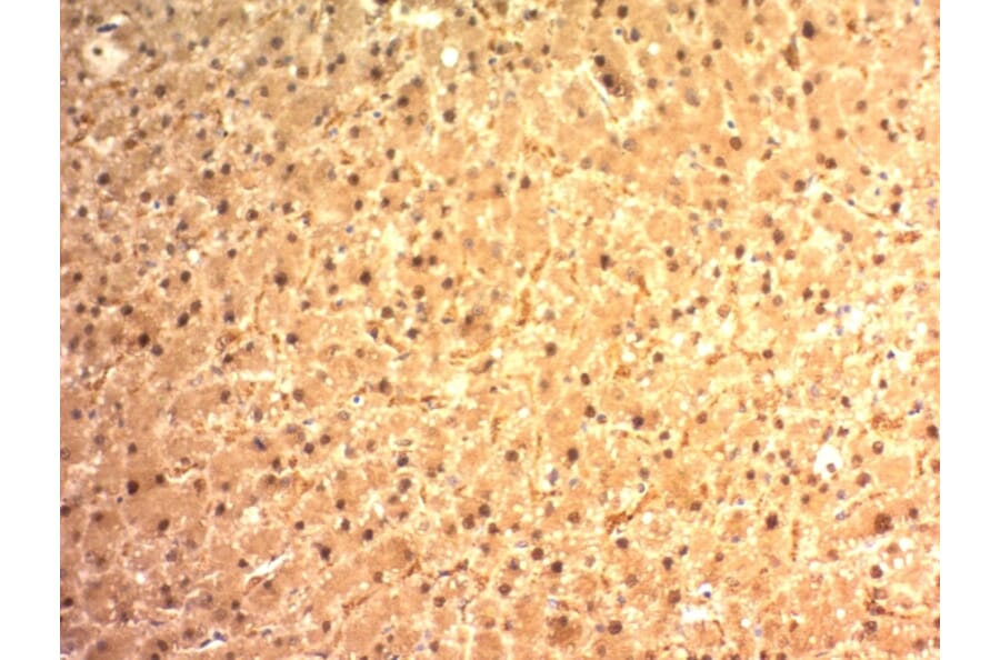 Immunohistochemistry - Anti-Glypican 3 Antibody [SPM595] (A248728) - Antibodies.com