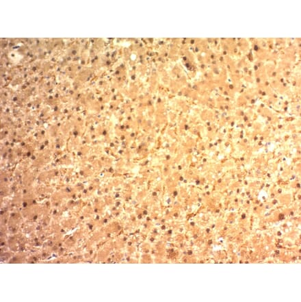 Immunohistochemistry - Anti-Glypican 3 Antibody [SPM595] (A248728) - Antibodies.com