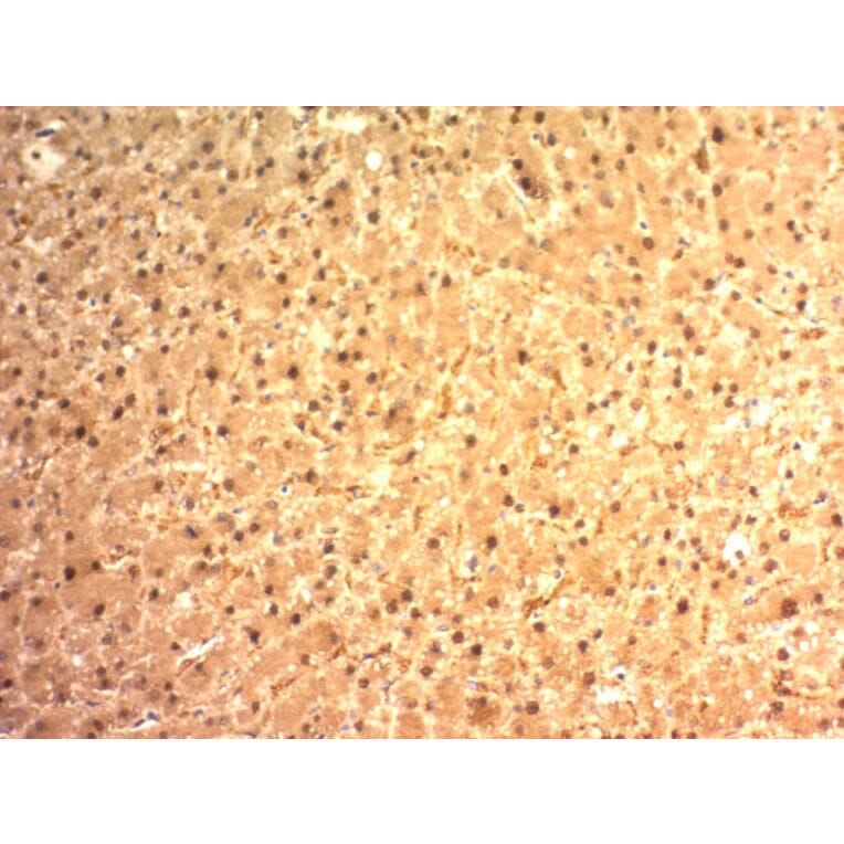 Immunohistochemistry - Anti-Glypican 3 Antibody [SPM595] (A248728) - Antibodies.com