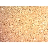 Immunohistochemistry - Anti-Glypican 3 Antibody [SPM595] (A248728) - Antibodies.com