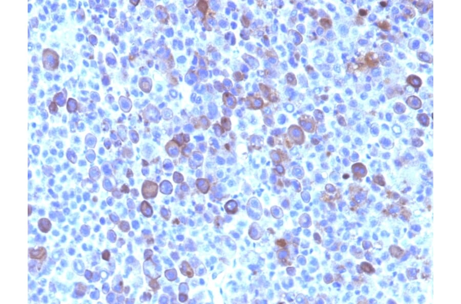 Immunohistochemistry - Anti-Glypican 3 Antibody [SPM595] (A248728) - Antibodies.com