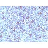 Immunohistochemistry - Anti-Glypican 3 Antibody [SPM595] (A248728) - Antibodies.com