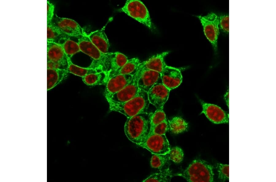 Immunofluorescence - Anti-Glypican 3 Antibody [SPM595] (A248728) - Antibodies.com