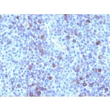 Immunohistochemistry - Anti-Glypican 3 Antibody [GPC3/863] (A248729) - Antibodies.com