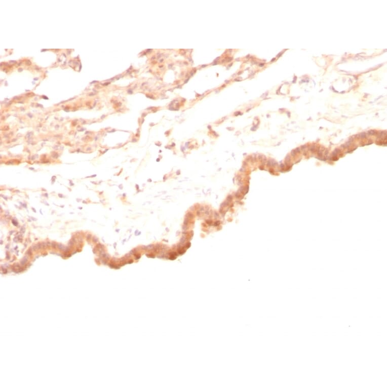 Immunohistochemistry - Anti-Glypican 3 Antibody [GPC3/863] (A248729) - Antibodies.com