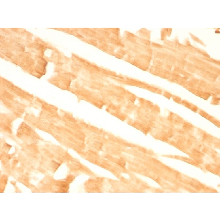 Immunohistochemistry - Anti-Glypican 3 Antibody [GPC3/863] (A248729) - Antibodies.com