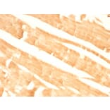 Immunohistochemistry - Anti-Glypican 3 Antibody [GPC3/863] (A248729) - Antibodies.com