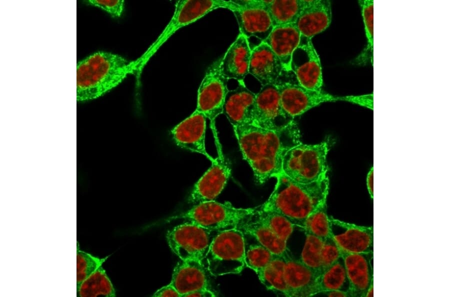 Immunofluorescence - Anti-Glypican 3 Antibody [GPC3/863] (A248729) - Antibodies.com
