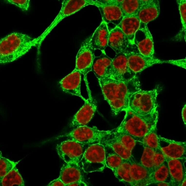 Immunofluorescence - Anti-Glypican 3 Antibody [GPC3/863] (A248729) - Antibodies.com