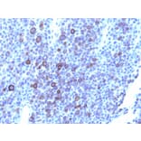 Immunohistochemistry - Anti-Glypican 3 Antibody [1G12 + GPC3/863] (A248730) - Antibodies.com