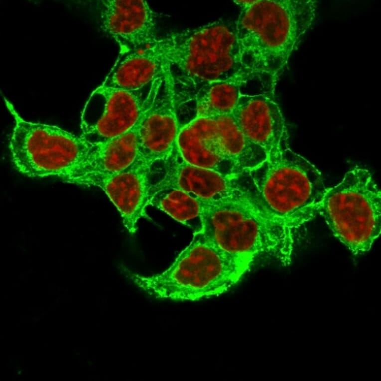 Immunofluorescence - Anti-Glypican 3 Antibody [1G12 + GPC3/863] (A248729) - Antibodies.com