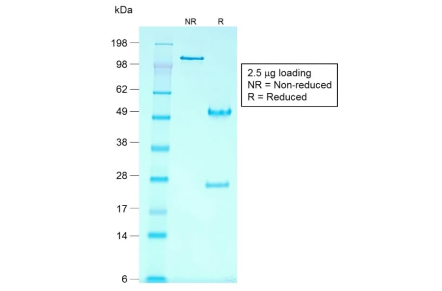 SDS-PAGE - Anti-Glypican 3 Antibody [rGPC3/863] (A248731) - Antibodies.com