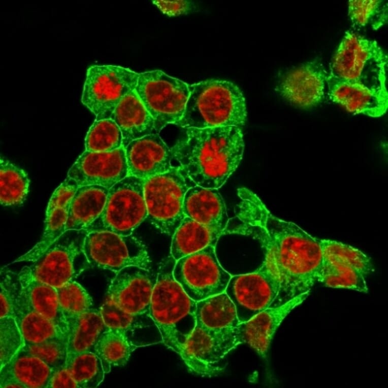 Immunofluorescence - Anti-Glypican 3 Antibody [rGPC3/863] (A248731) - Antibodies.com