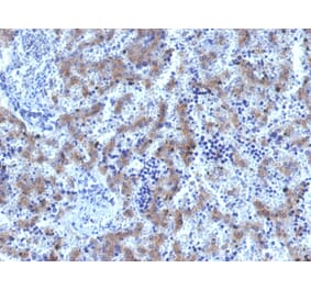 Immunohistochemistry - Anti-Glypican 3 Antibody [GPC3/1534R] (A248732) - Antibodies.com