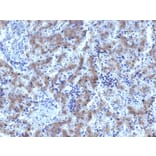 Immunohistochemistry - Anti-Glypican 3 Antibody [GPC3/1534R] (A248732) - Antibodies.com