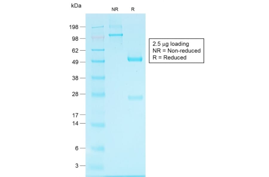SDS-PAGE - Anti-Glypican 3 Antibody [GPC3/1534R] (A248732) - Antibodies.com
