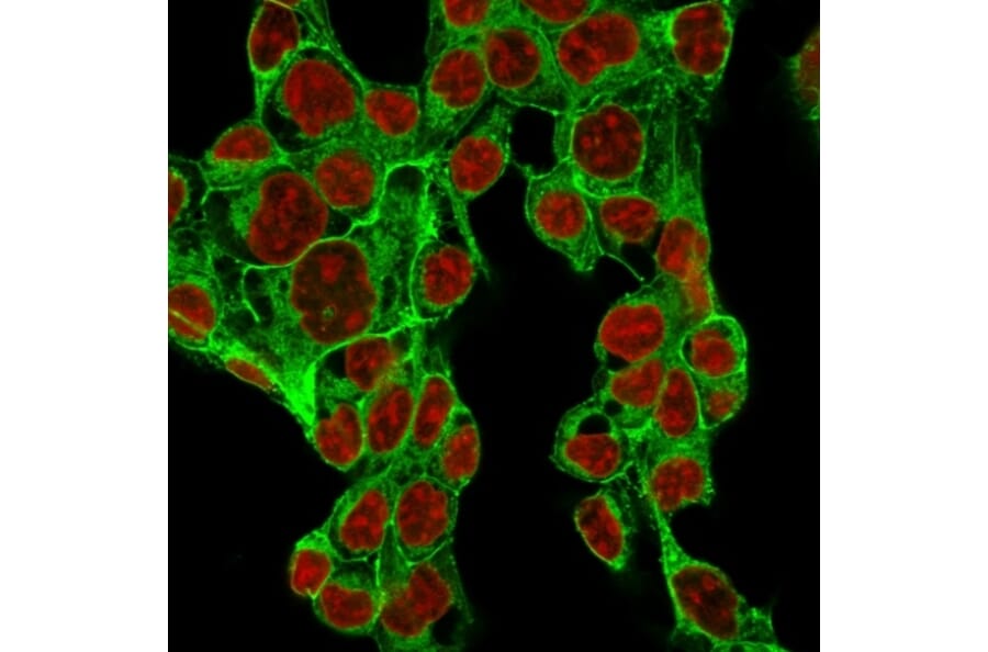 Immunofluorescence - Anti-Glypican 3 Antibody [GPC3/1534R] (A248732) - Antibodies.com