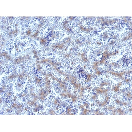 Immunohistochemistry - Anti-Glypican 3 Antibody (A248732) - Antibodies.com