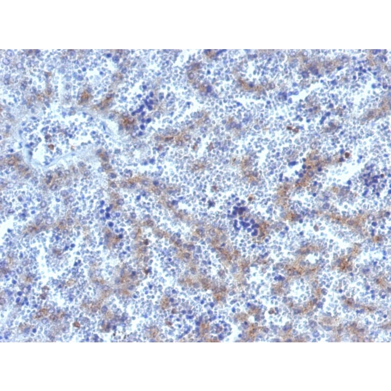 Immunohistochemistry - Anti-Glypican 3 Antibody (A248732) - Antibodies.com