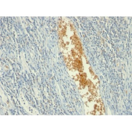 Immunohistochemistry - Anti-AMPD3 Antibody [AMPD3/901] (A248734) - Antibodies.com