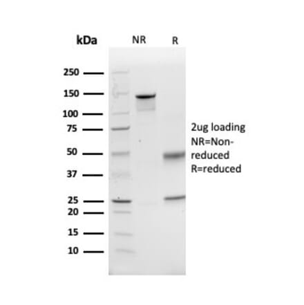 SDS-PAGE - Anti-GCLM Antibody [CPTC-GCLM-1] (A248735) - Antibodies.com