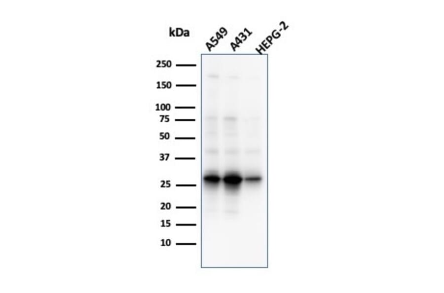 Western Blot - Anti-GCLM Antibody [CPTC-GCLM-1] (A248735) - Antibodies.com